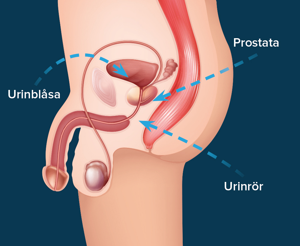 Prostata ejakulation